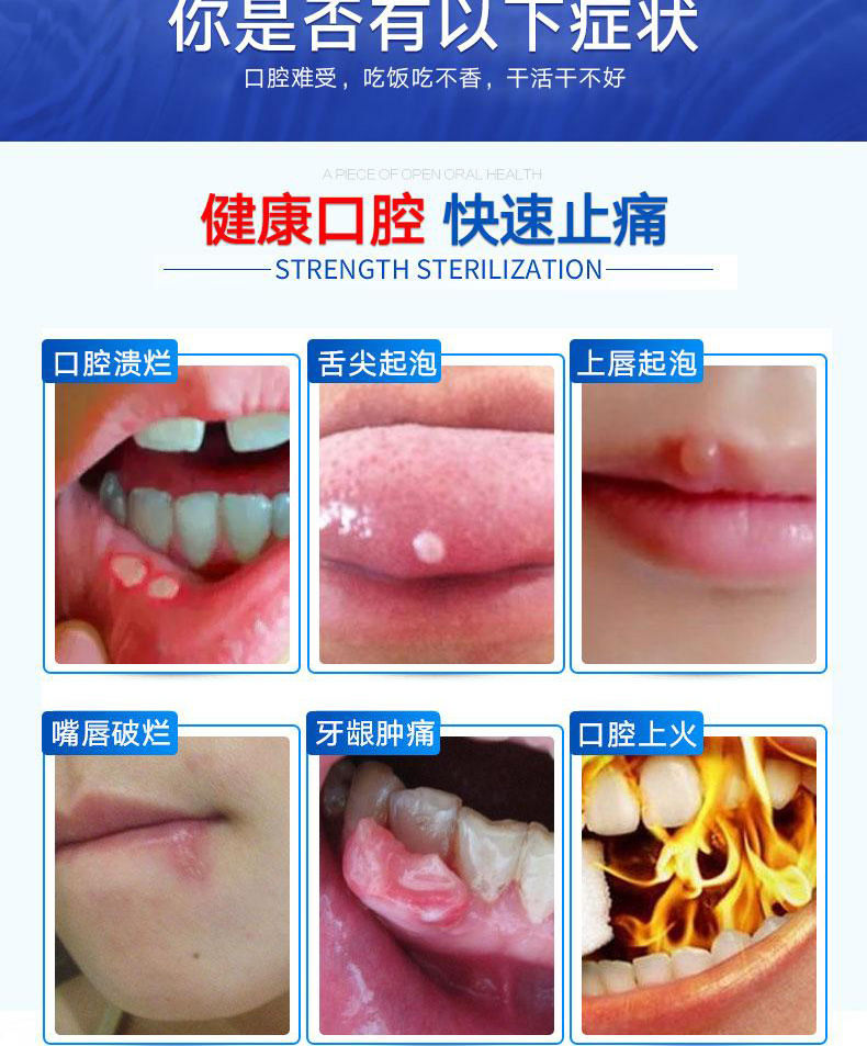 京选优品拓实牙安牙宝口喷牙疼牙痛牙龈肿喷雾剂牙舒牙喷剂明康l型