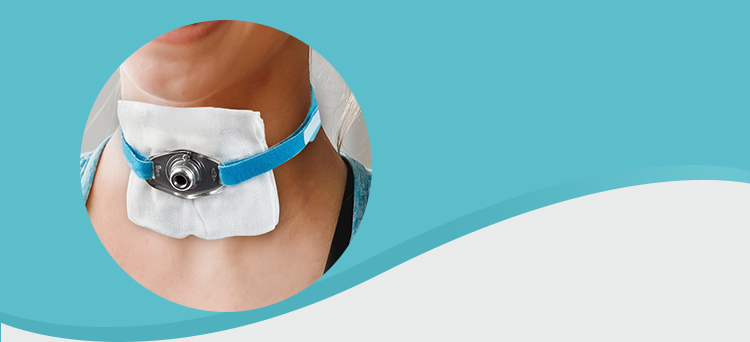 京健康气切固定带气管切开套管固定器绳护理术后喉管绑带导插管粘带