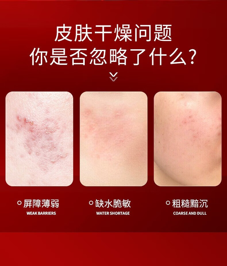 SIKN护肤品套装水乳礼盒补水保湿节日送礼化妆品全套五件套 多肽胶原蛋白五件套