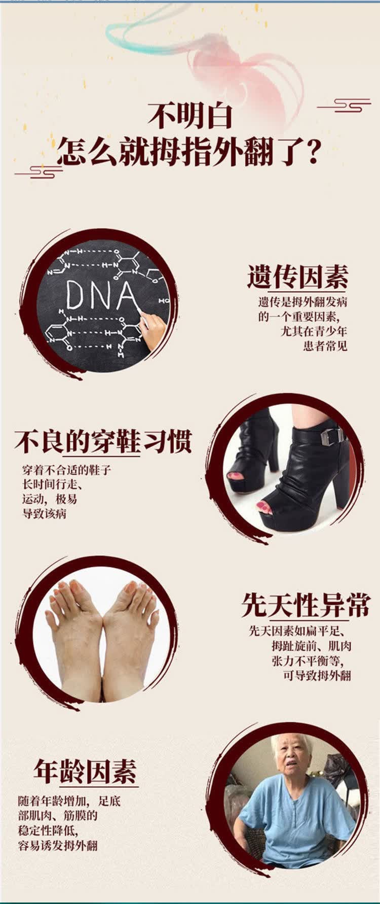 顺丰发货共勉17号大指姆外翻矫拇指外翻肌大拇指外翻十七拇囊炎神器液