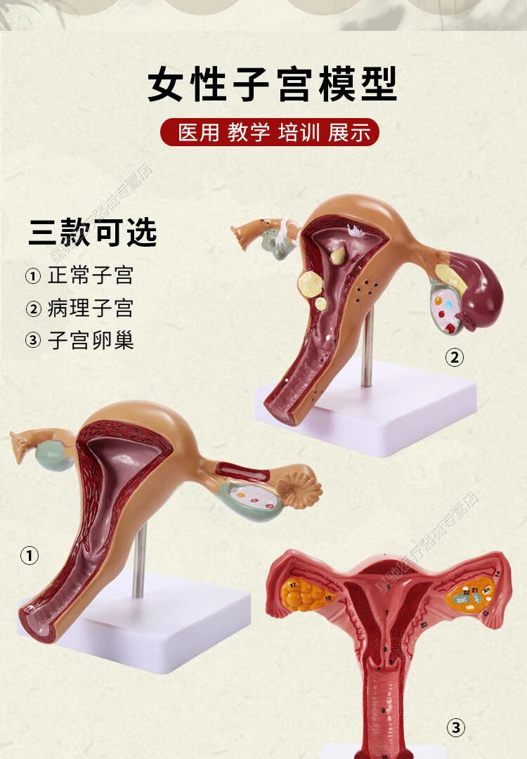人体子宫附件模型女性医学生殖器卵巢病理病变结构解剖教学具娇之乐