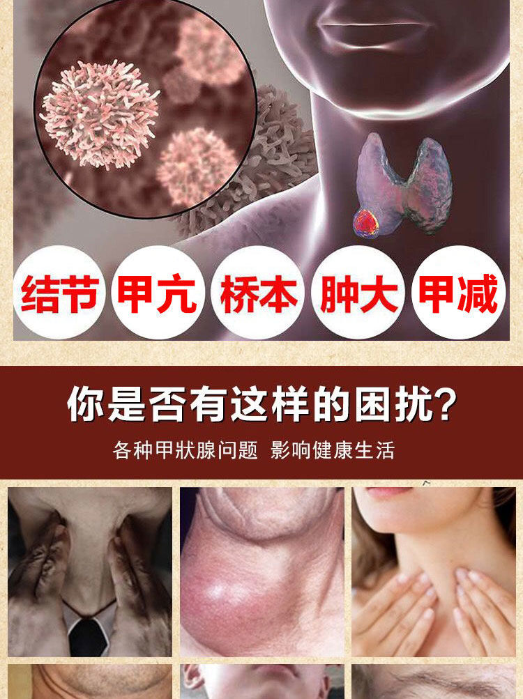 甲狀腺凝膠結節貼脖子腫大散結膏淋巴結腫大頸部消癭膏橋本氏甲腺