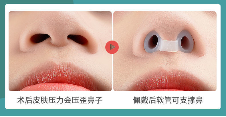鼻中隔偏曲神器skk鼻综合隆鼻术后鼻孔支撑器硅胶塑形歪鼻子固定器