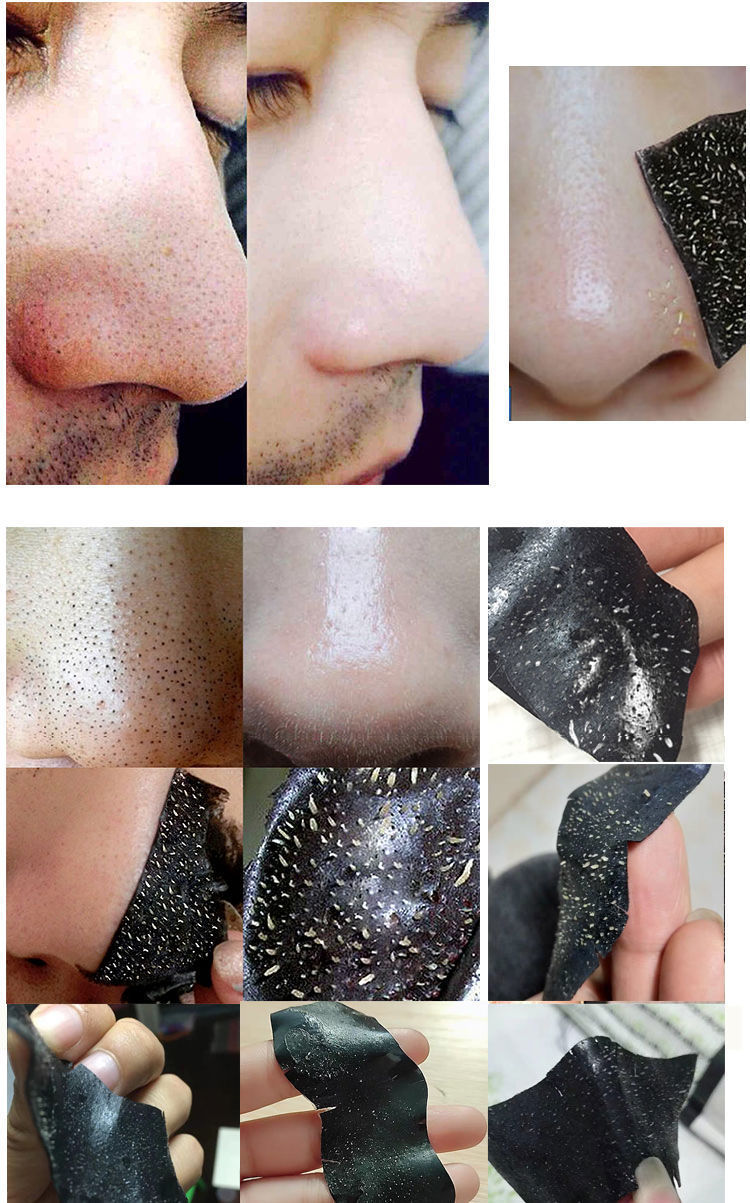 去黑头鼻贴粉刺鼻子鼻头贴吸黑头收缩毛孔学生螨虫黑头贴懒人鼻贴20片