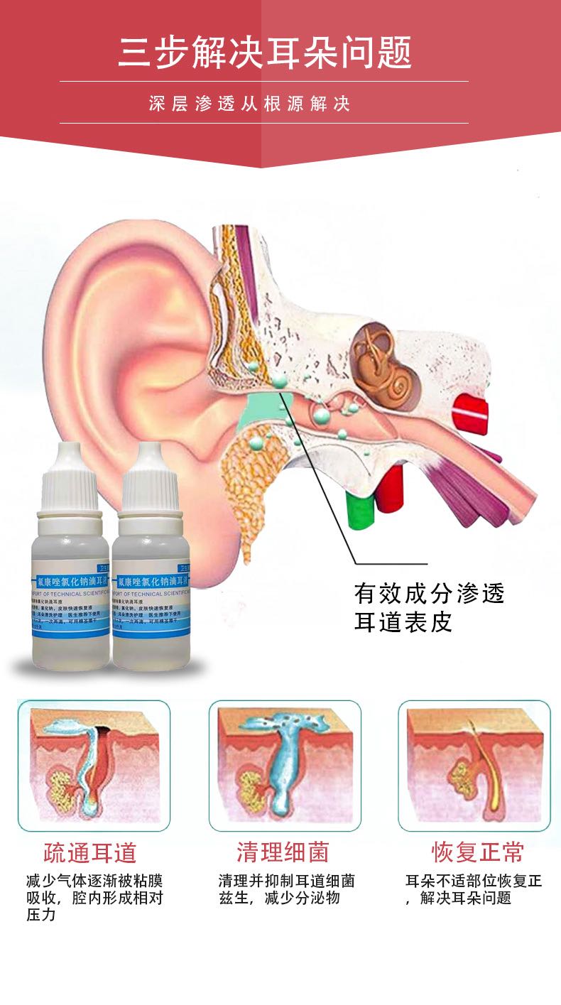 氟康唑滴耳液感染外耳道炎中耳炎流膿水氟康挫可除耳朵黴菌