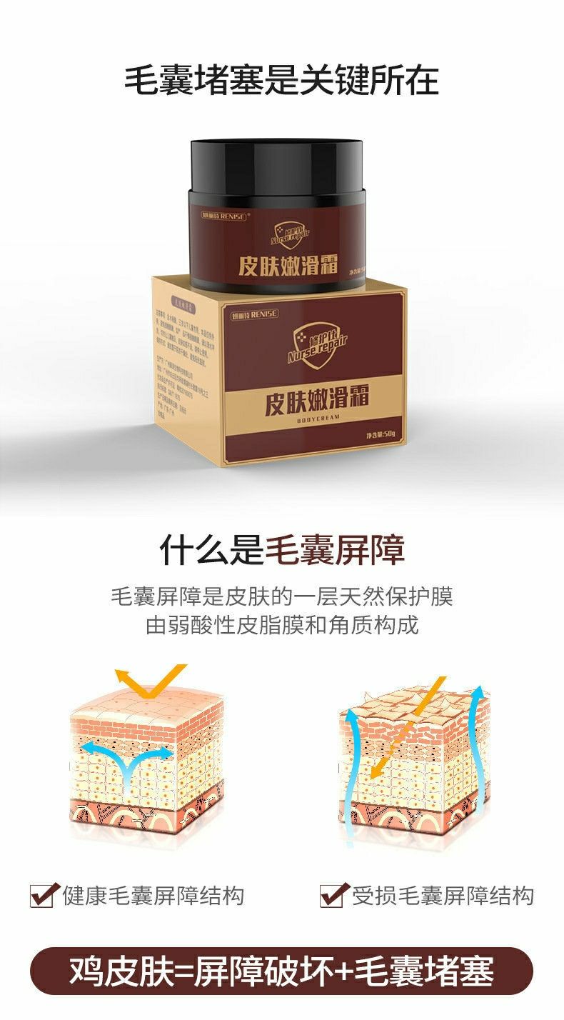 鱼鳞病鸡皮肤的人好惨(鱼鳞皮肤和鸡皮肤怎么治疗)