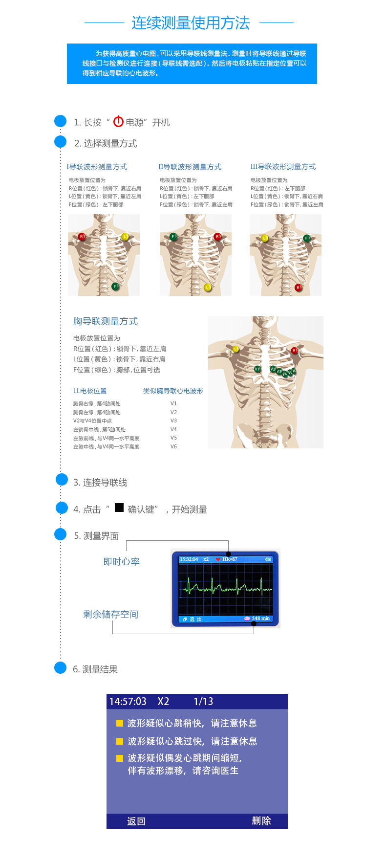 心电监护仪位置图图片