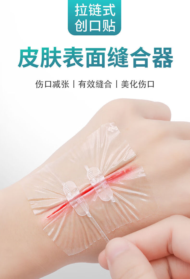 减张器免缝拉链式创可贴伤口减张贴术后医用疤痕拉链创口贴减张器1盒2