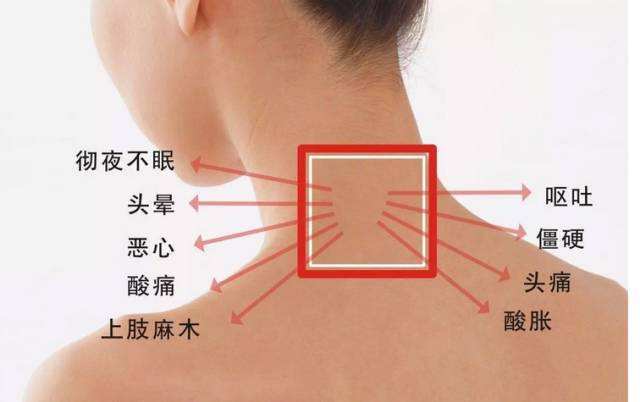 颈椎贴富贵包艾灸艾叶膏艾草脖子头晕疼痛自发热肩颈专用买11共2盒