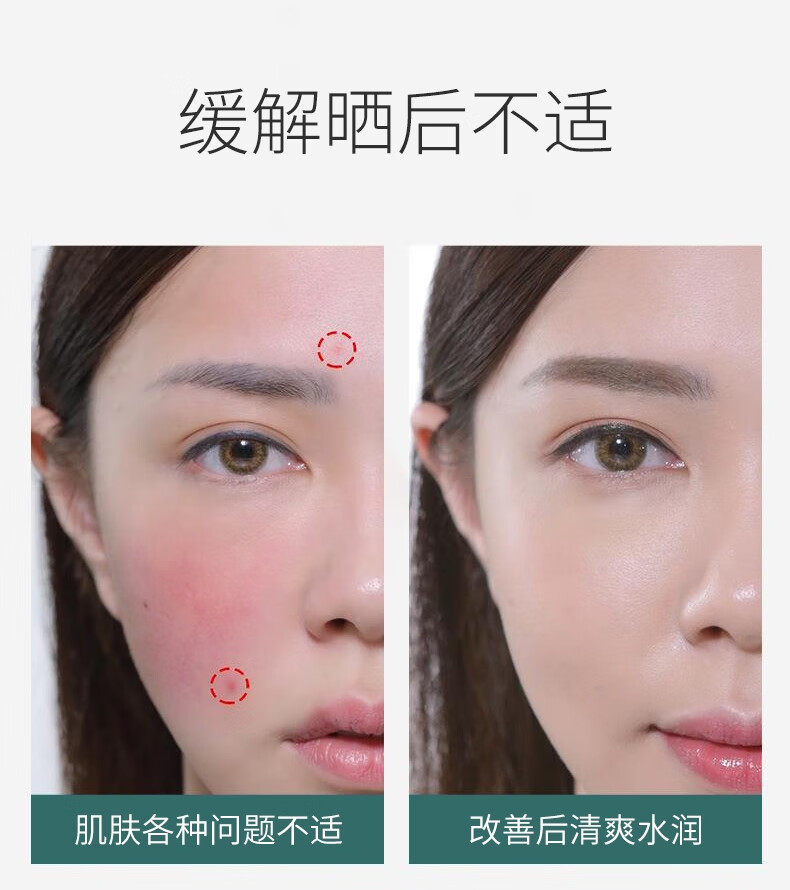 禹泉【官方授权】禹泉芦荟胶库拉索晒后舒润补水保湿女男士专用凝胶 1瓶*500g
