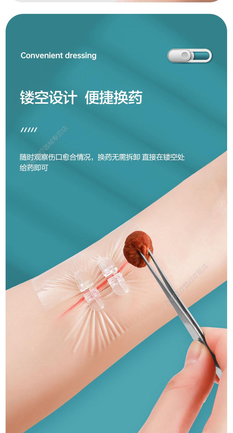 减张贴缝合器贴减张器拉链式创口贴创可贴疤痕皮肤免缝针1盒装共2片2