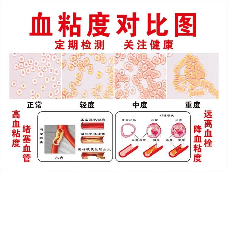 血脂 蟎蟲血液顯微鏡觀察儀血液分析儀器 掛圖【圖片 價格 品牌 報價