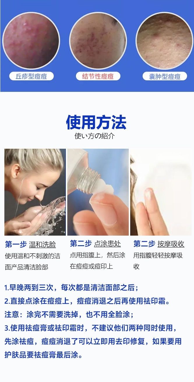 伊芝清浅姿兰】香港祛.痘膏祛痘印淡化痘印青春痘闭口粉刺去痘学生祛痘 祛痘洗面奶一支