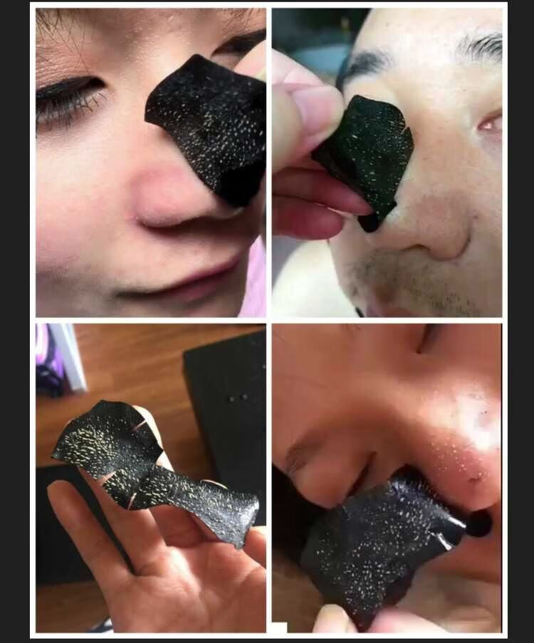 男女通用去黑头白头粉刺螨虫收缩毛孔去黑头鼻贴5片30片选鼻贴5片