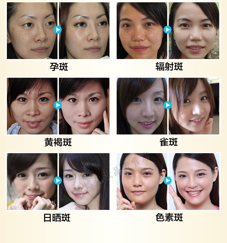 马油楚精华霜女男用素颜霜去除褐斑雀斑日晒斑老年斑去斑霜30g正常