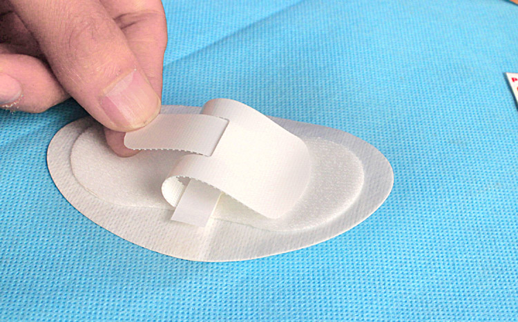 导管固定贴导尿管胆汁引流管固定胶布鼻饲管贴鼻管胶带胆管固定贴定制