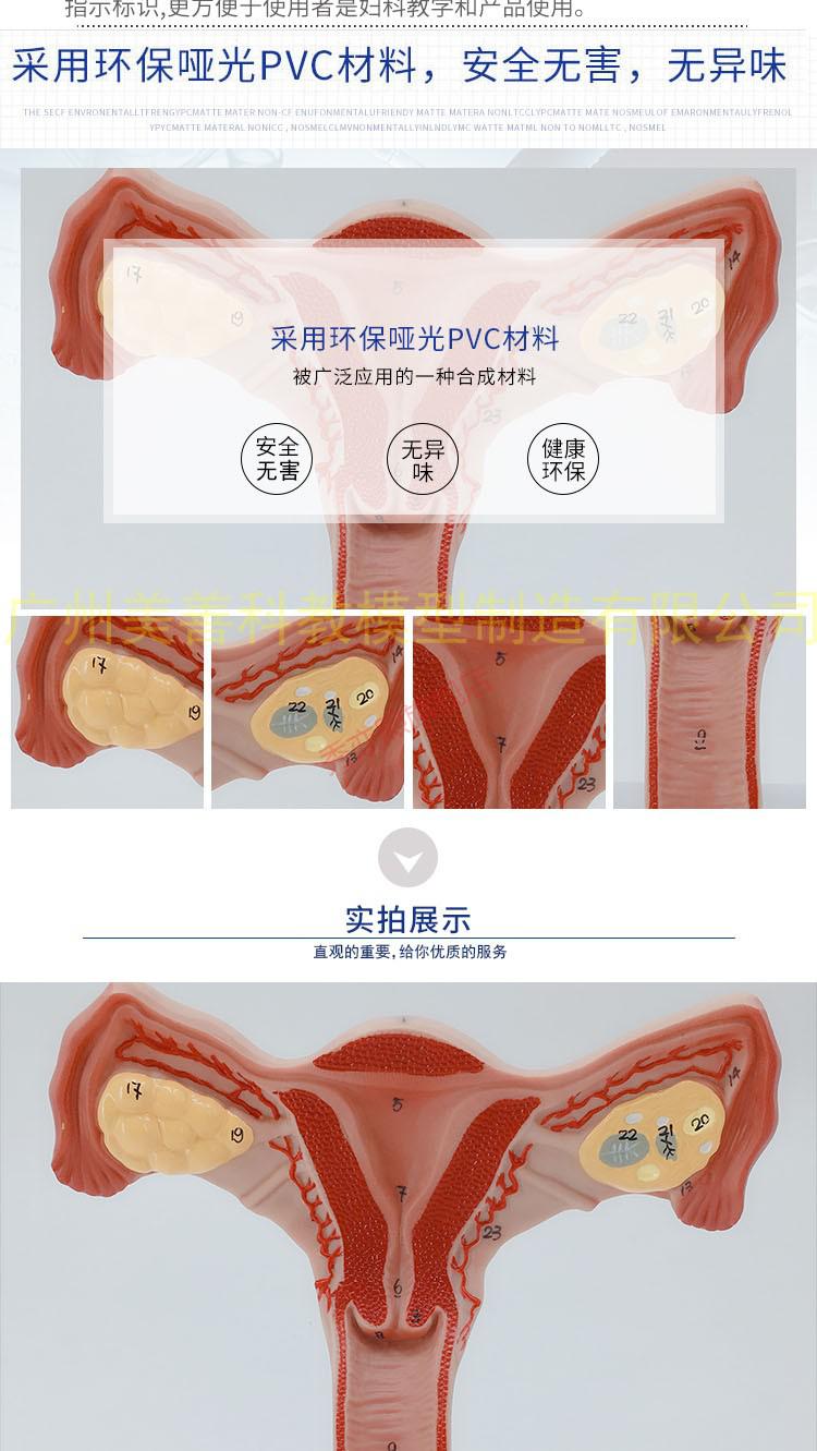 子宫模具图片