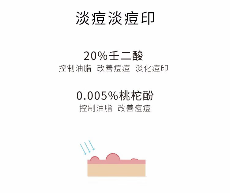 John Jeff壬二酸乳霜女杜鹃花酸改善闭口粉刺黑头痘痘淡化痘印男女通用 20%壬二酸15g 乳霜
