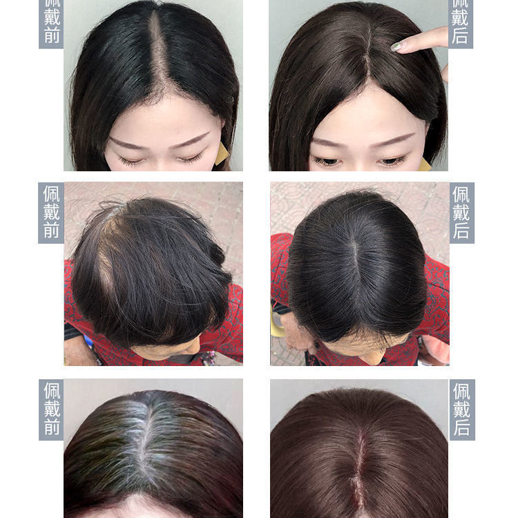 头顶补发片女遮白发贴假发片真发块增发量轻薄无痕隐形蓬松自然黑分缝