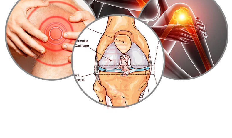 滑膜炎膏贴腰肩用膝关节贴可配搭日本股骨髋关节膝盖积液喷剂疼痛冷敷