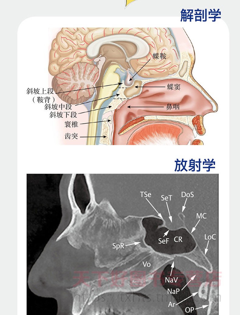 斜坡解剖结构图图片