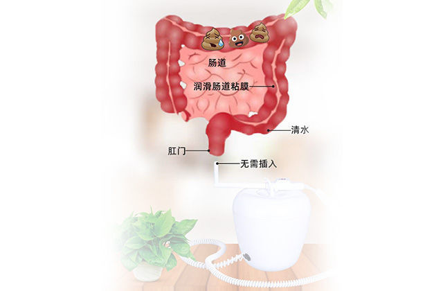 灌肠神器家用通便清肠便秘通便器肠道水疗仪通便便秘润肠通便排便