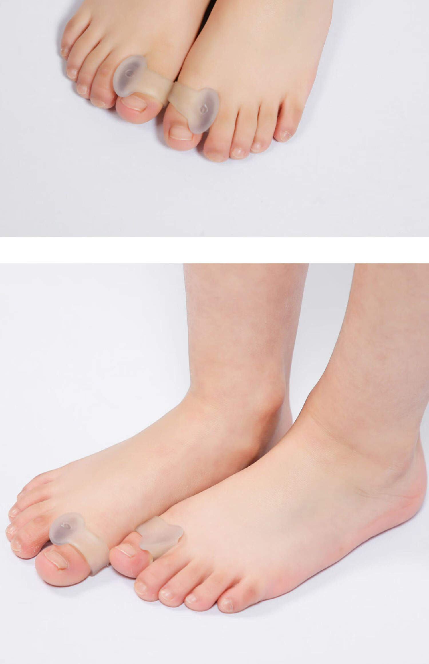 药房直售宝宝婴儿脚趾矫正器儿童拇指外翻纠正重叠弯曲内扣纠正矫形器