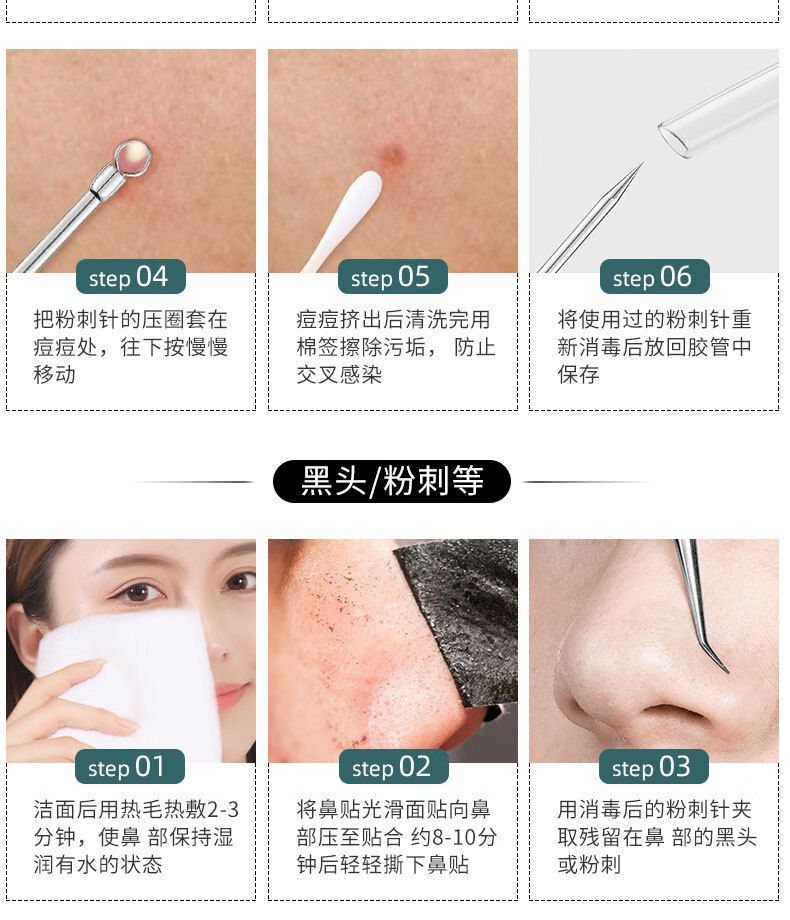 不锈钢粉刺针弯头粉刺夹痘痘镊子挤黑头细胞夹美容暗疮针 塑料盒装粉刺针+斜咀5件套