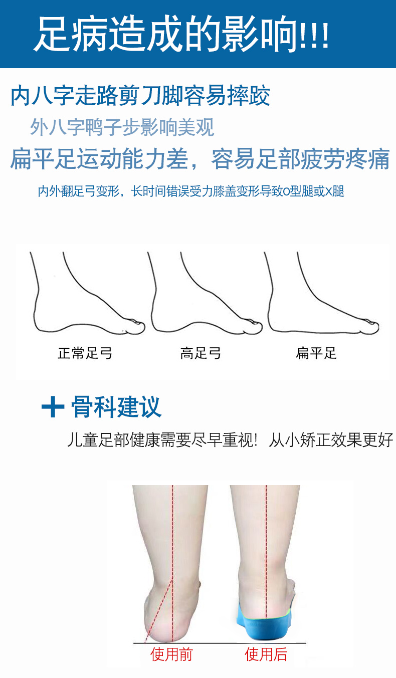小米通用内八字矫正器儿童扁平足鞋垫宝宝内外八字足外翻足弓塌陷支撑