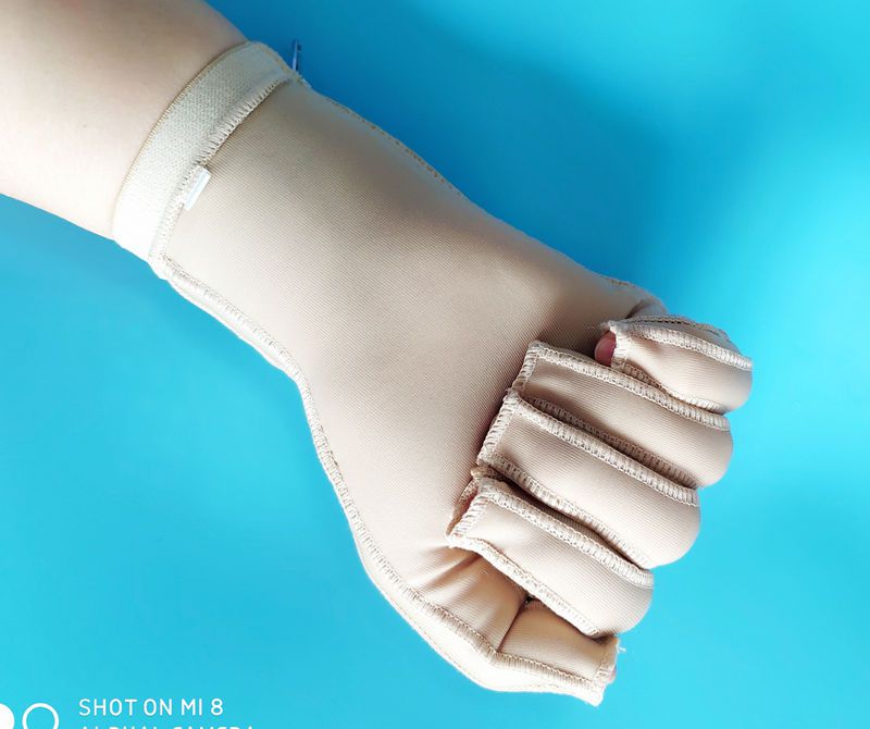 弹力套疤痕加压压力手套弹力套手指手掌手背烧伤植皮抑疤痕术后加压