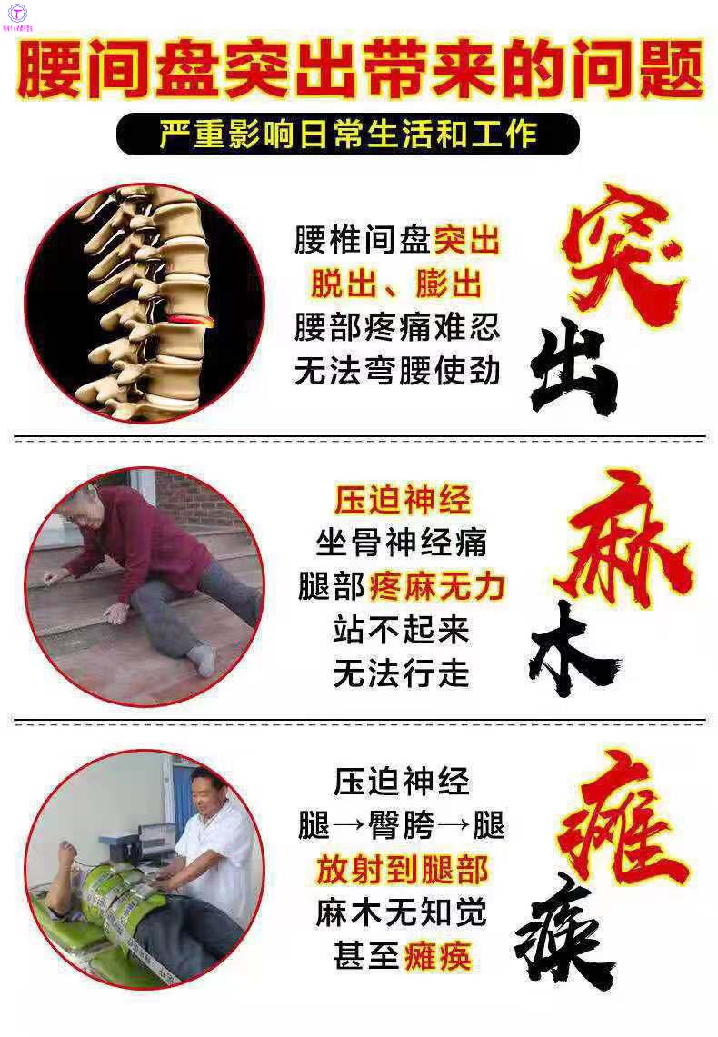 腰椎压迫梨状肌坐骨神经痛腰疼腿疼走珠腰椎间盘压迫神经腿麻痛刺痛腰