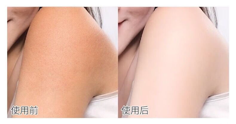 抹身体乳会不会长鸡皮肤(用身体乳会使鸡皮肤变严重吗)