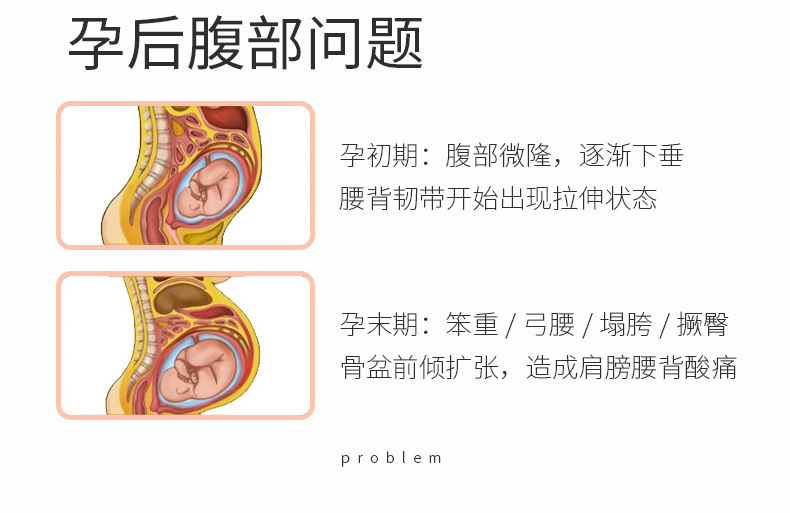 子宫右旋图示图片