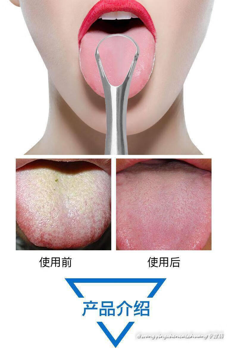 不锈钢食品级刮舌苔器舌苔板清洁除i口臭舌头器成人口腔清洁430材质