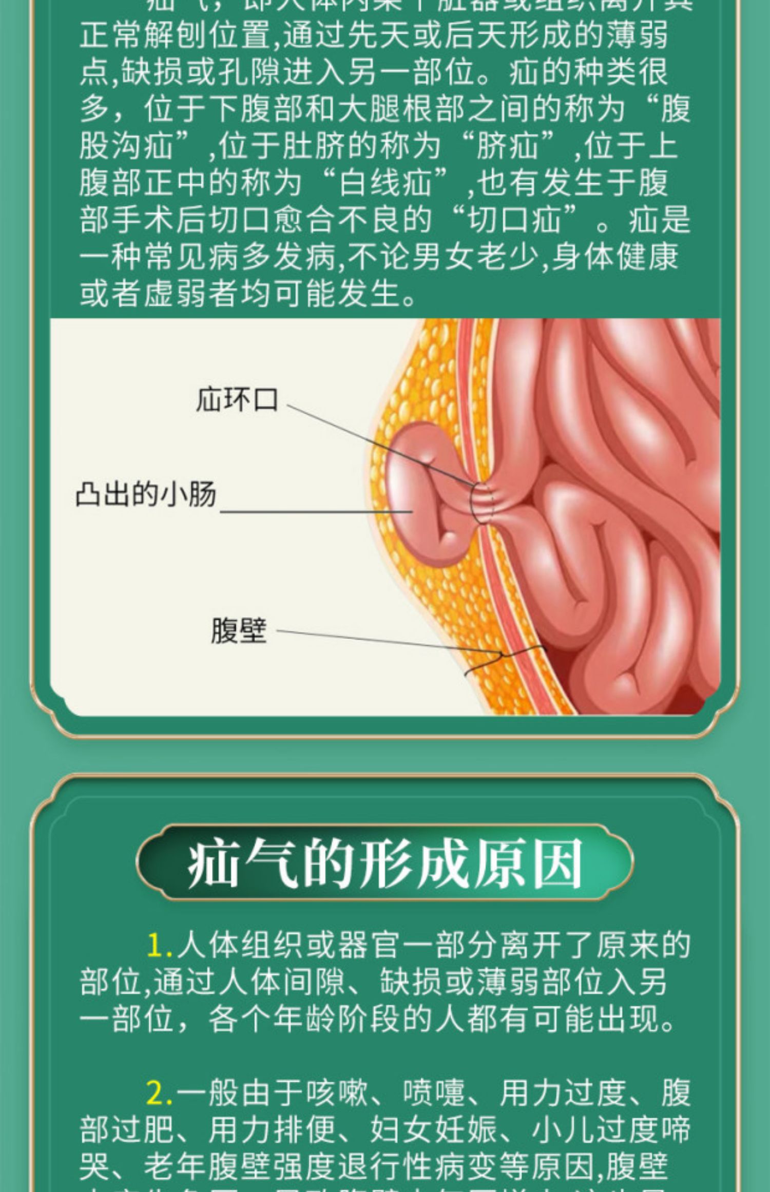 疝氣貼腹股溝斜疝氣帶治療中老年老人康臍疝貼嬰兒御疝冷敷貼