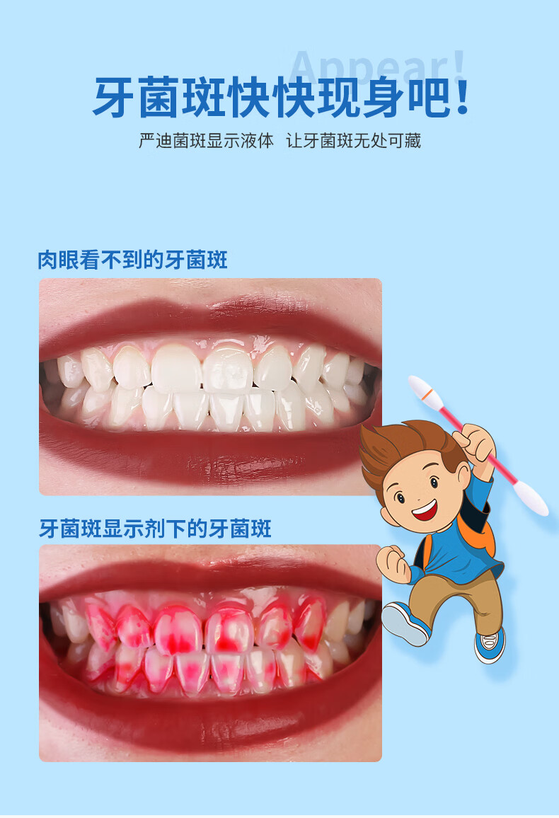 2022新版严迪儿童成人牙菌斑显示剂口腔牙齿去牙垢显色神器染色祛除指