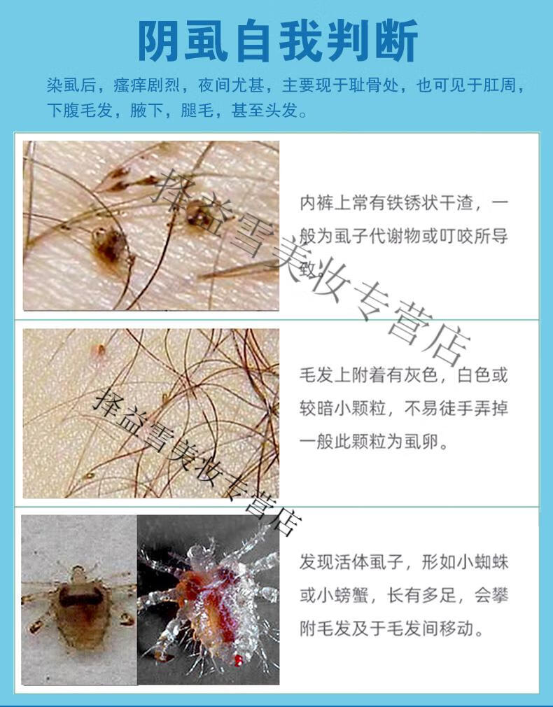 乔奈抑虱灵除阴虱体虱头虱虱卵跳蚤蜱虫小孩成人私处头发通用喷剂普通