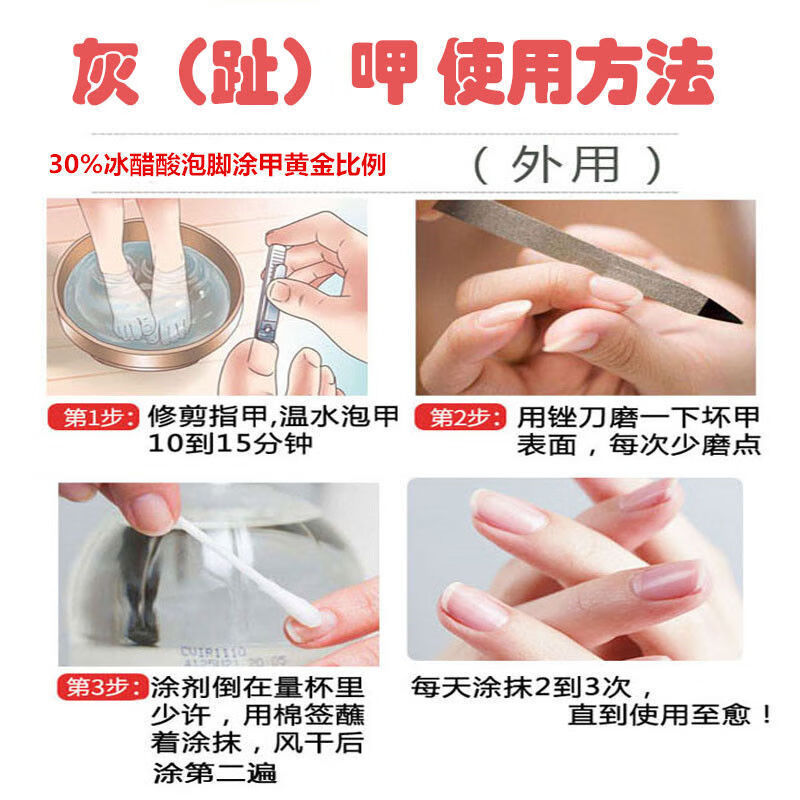 冰醋酸70%灰甲脚臭痒泡脚涂甲高浓度醋冰醋酸浓缩溶液醋酸70% 70%冰