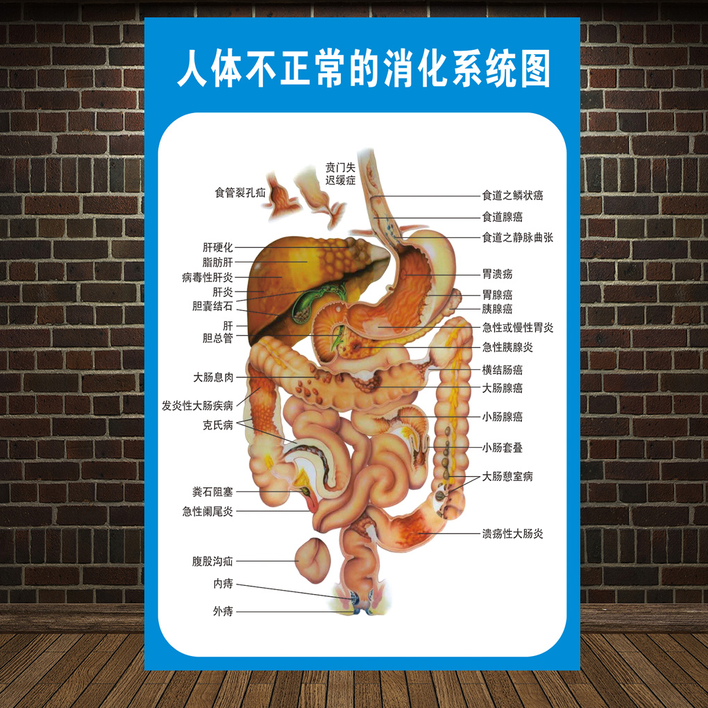 示意图医学宣传挂图人体器官医院布置海报 消化内科结构图及相关疾病