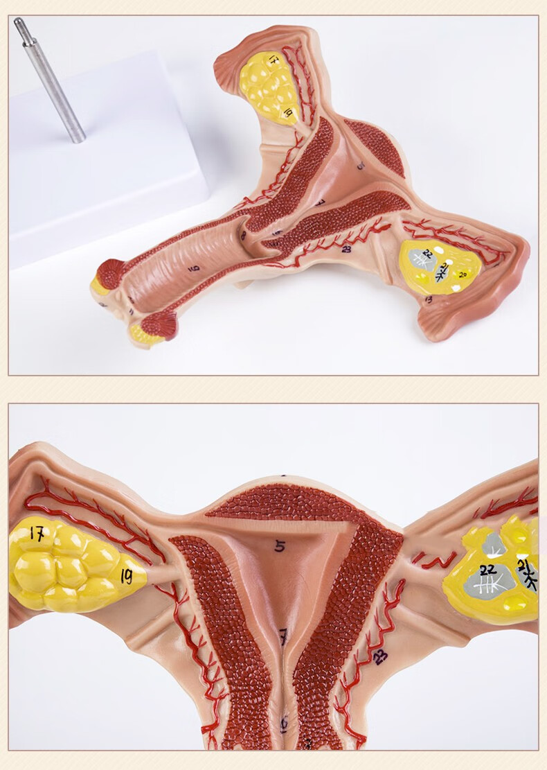 子宫模型卵巢女性内外生殖器官模型生殖科妇科医用演示卵巢子宫和病理