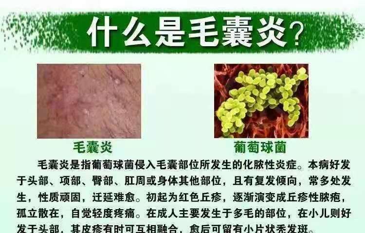 外阴长了个黑疙瘩图片图片