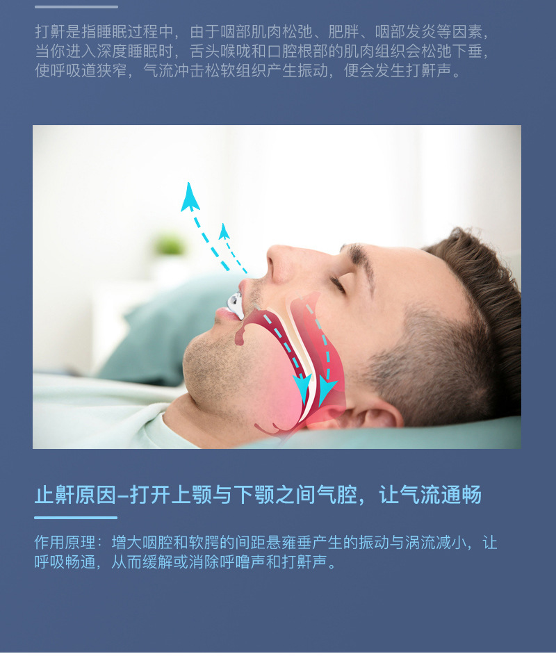 阻鼾器能阻止打鼾吗图片