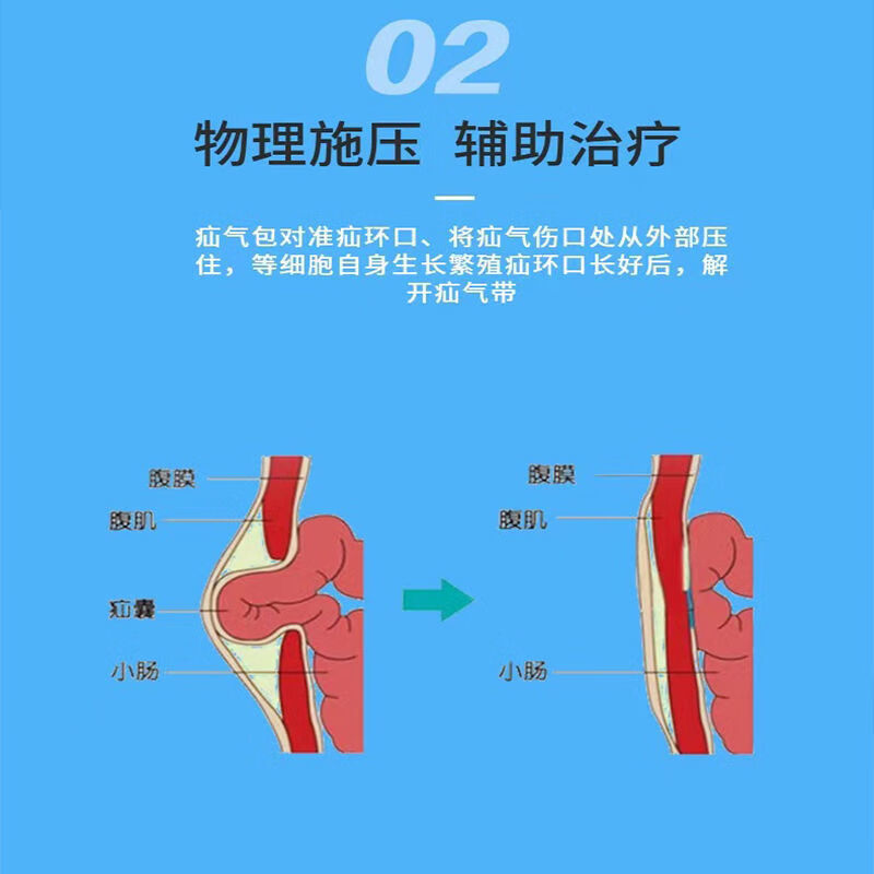 疝气带做法及图片大全图片