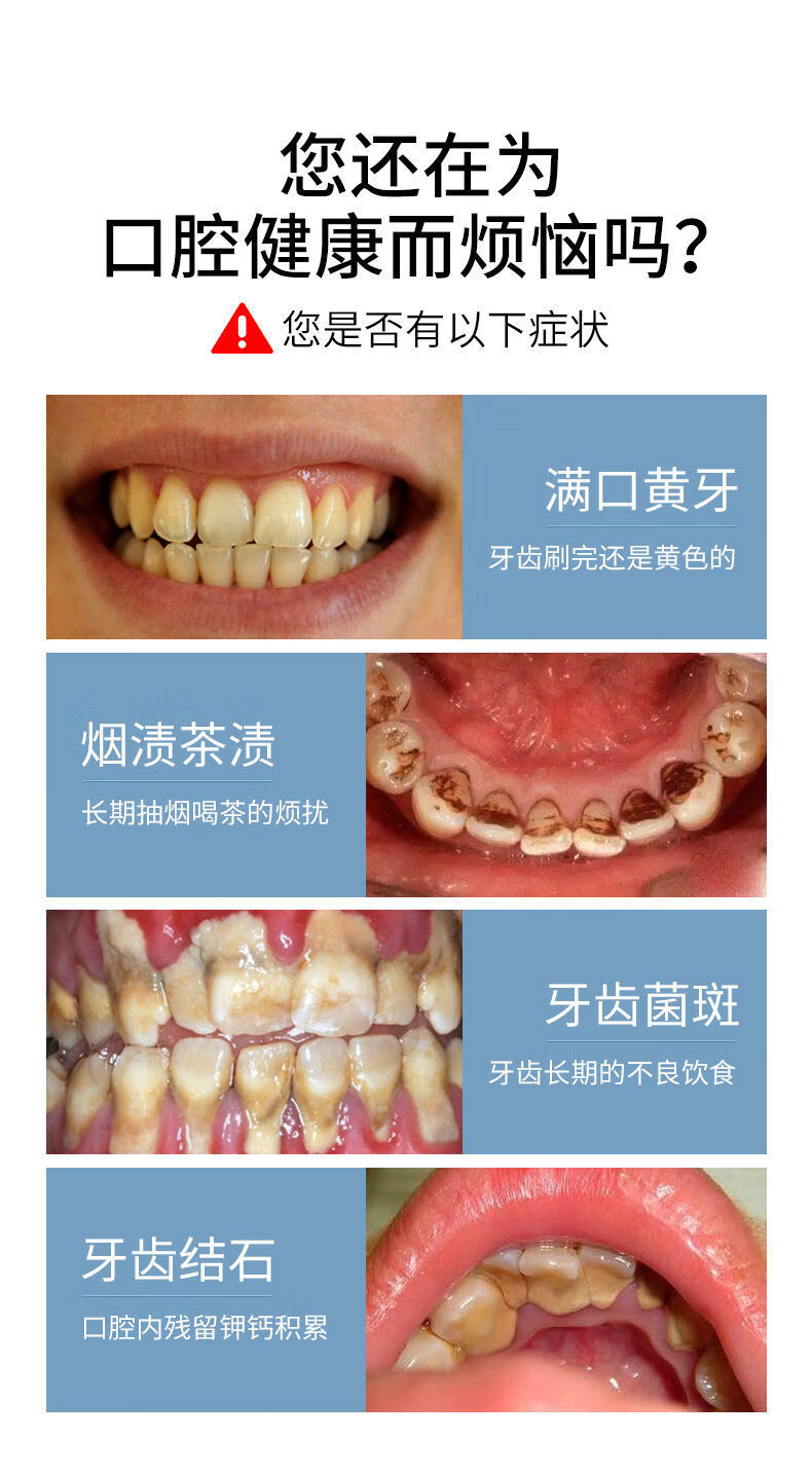 牙结石去除器清理器去牙垢洗牙神器声波电动家用洁牙器洗牙神器旦榄