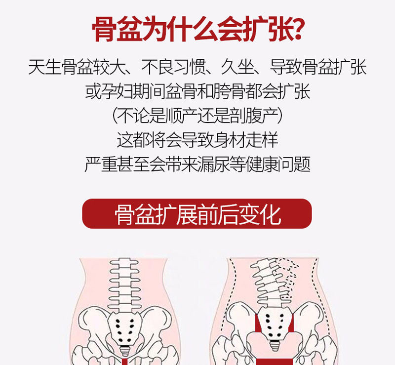 骨盆前傾後傾產後收胯腹直肌分離男女假胯寬神器恥骨修復盆骨三盒療程