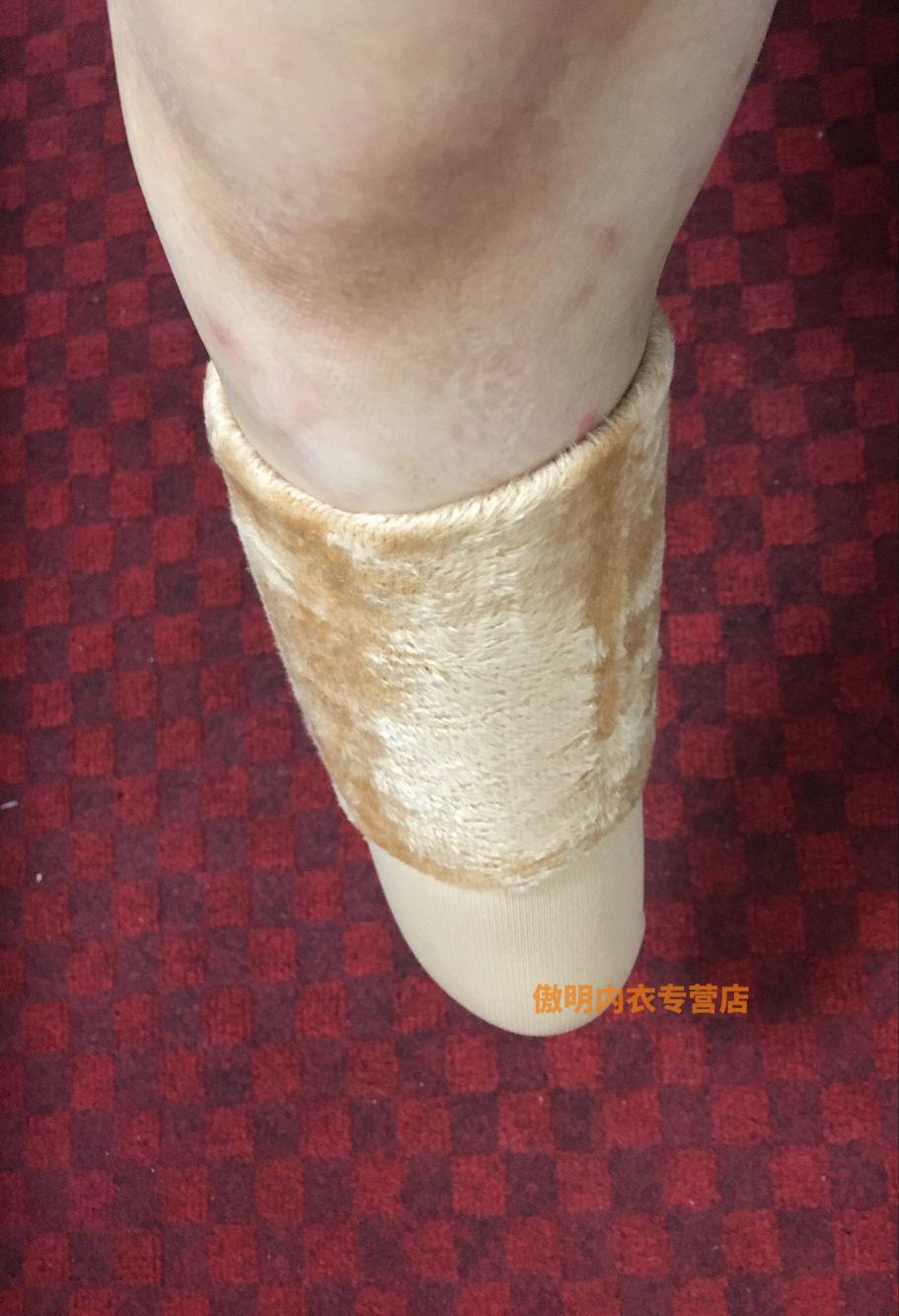 集衫坊 5只装小腿截肢假肢袜子棉义肢袜加厚残肢袜带绒毛袜套残疾人袜