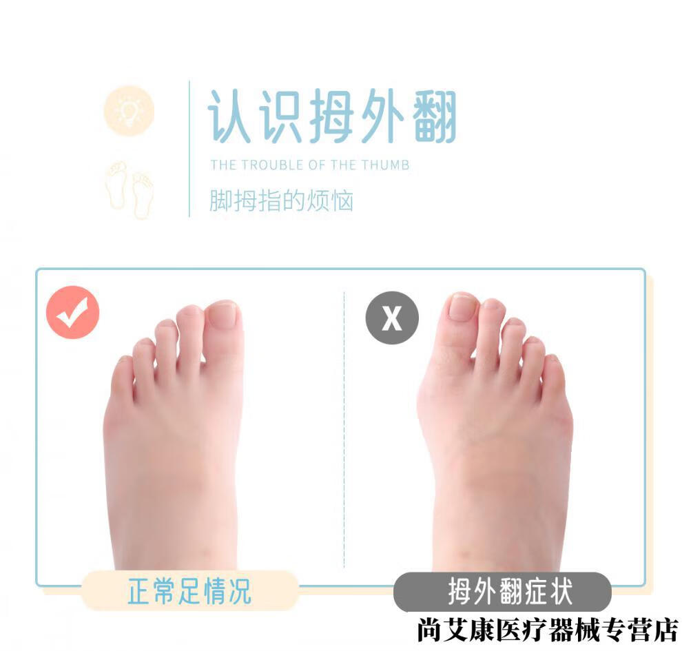 拇指外翻器医用级 儿童脚趾器拇外翻拇指分趾器男女士小孩大母足大