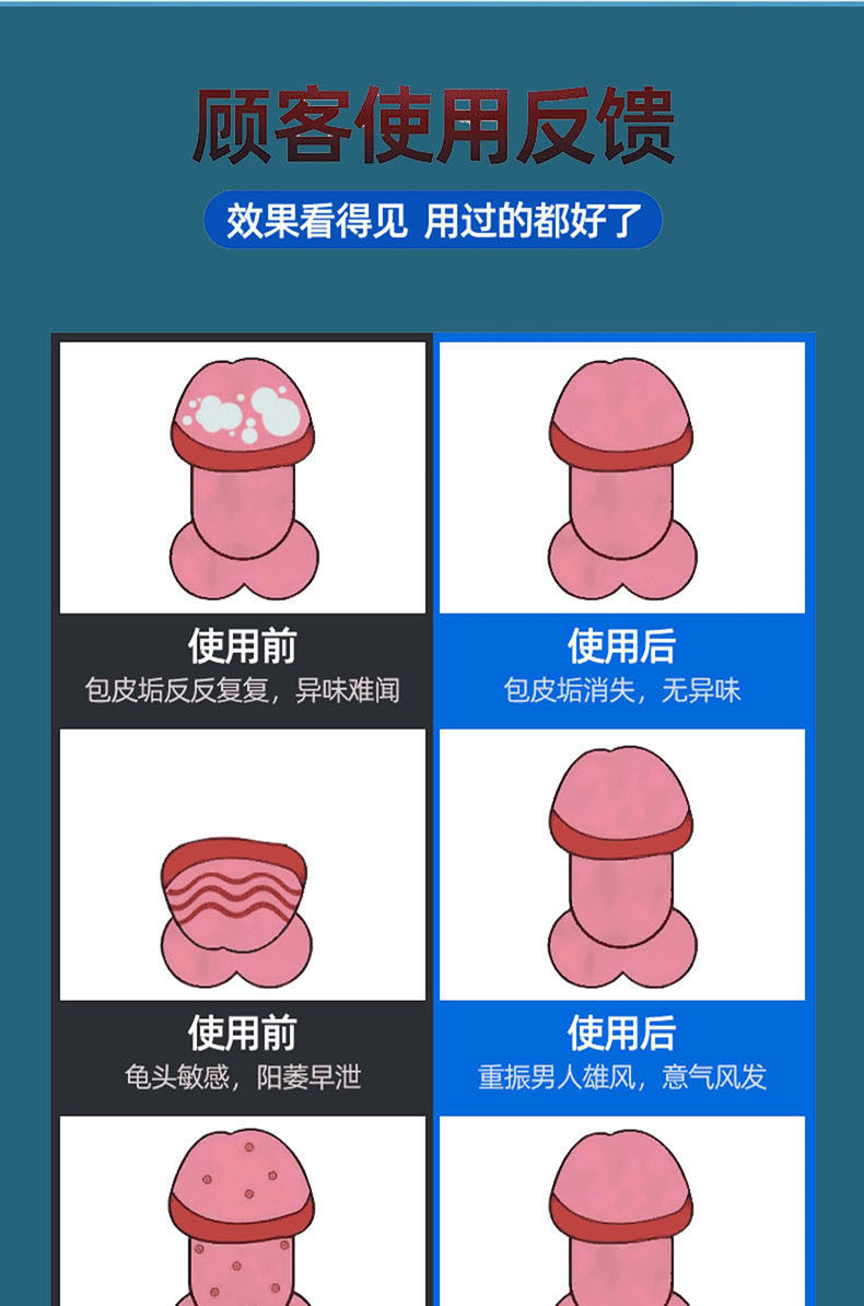 苗药炎包皮垢男科私处用药珍珠疹瘙痒霉菌性阴囊潮湿红点异味3盒乳膏