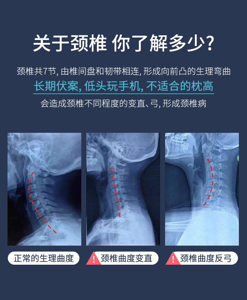 颈椎生理曲度反弓对比图片