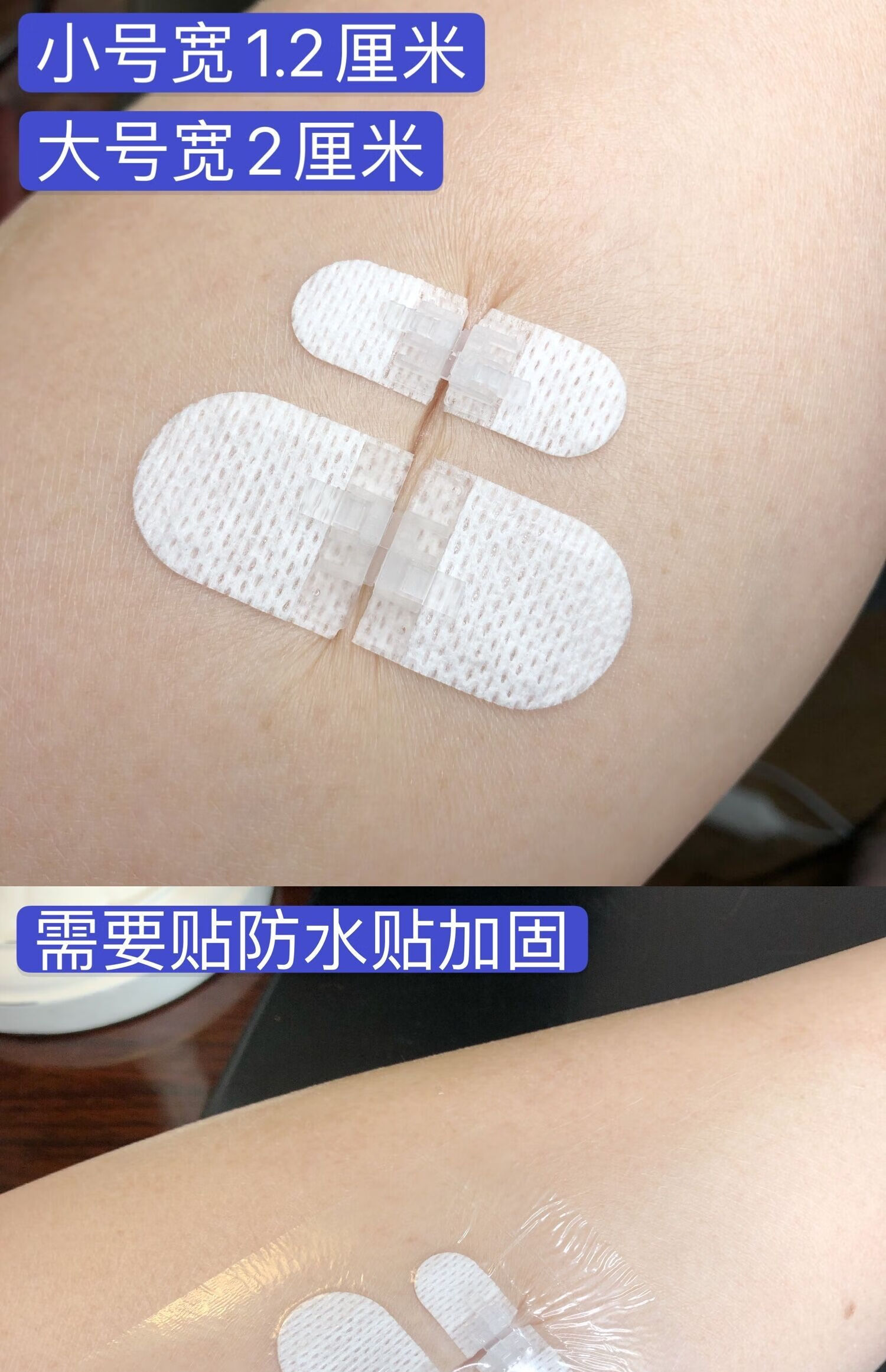 减张贴减张器ja皮肤减张贴儿童剖腹产拉链创可贴免缝胶带zip 小号1包3